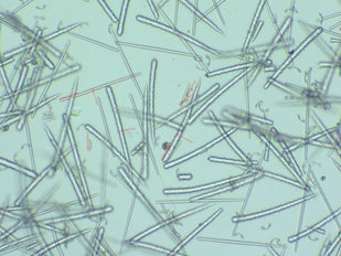 Heartleaf Exosomes