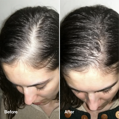Rosemary & Rice Water Hair Spray