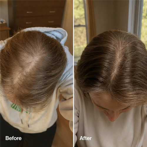 Rosemary & Rice Water Hair Spray