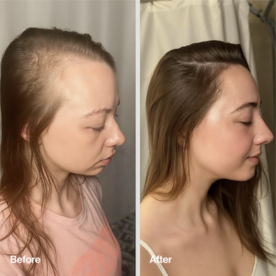 Rosemary & Rice Water Hair Spray