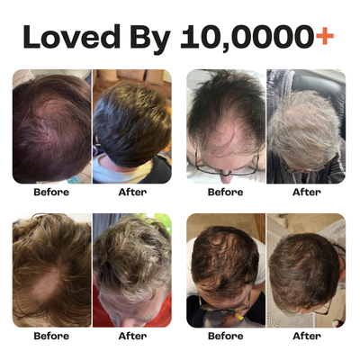Exosomes Hair Growth Serum with Brush