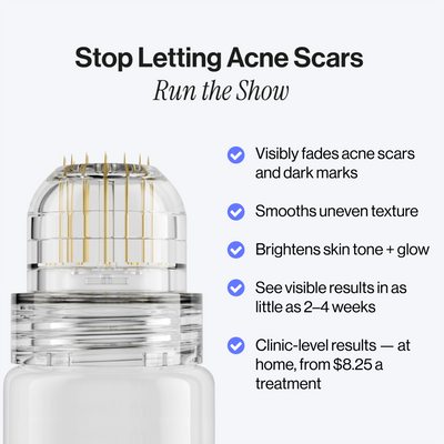 Microneedling Infusion Kit