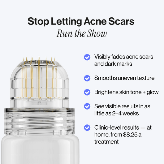 Microneedling Infusion Kit