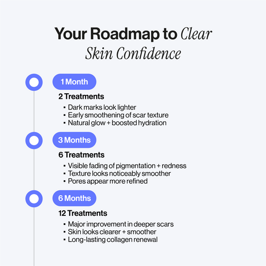 Microneedling Infusion Kit