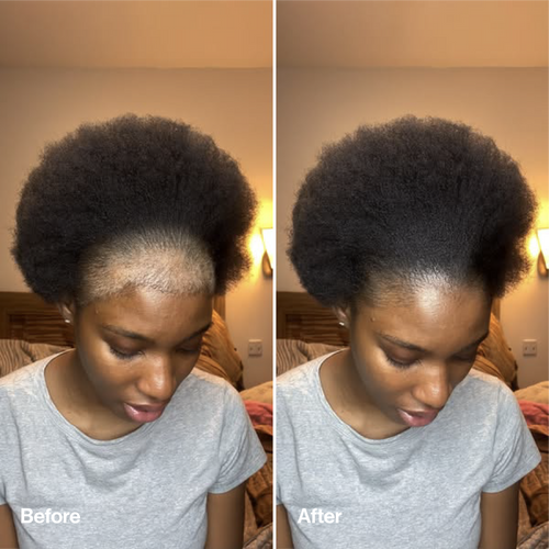 Rosemary & Rice Water Hair Spray