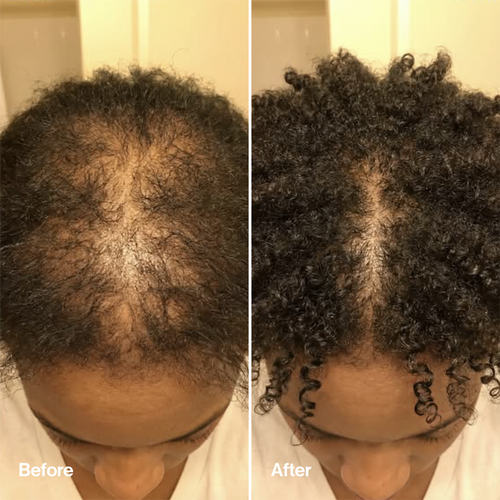 Rosemary & Rice Water Hair Spray