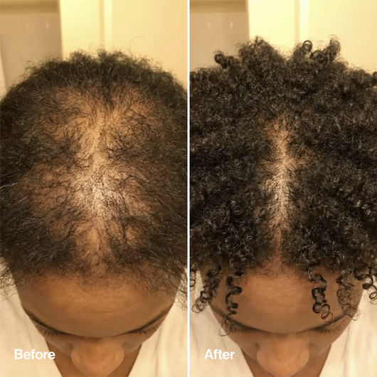 Rosemary & Rice Water Hair Spray